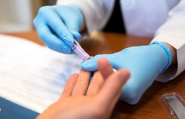 Detecção de casos de Aids no Rio Grande do Norte cresce 81,7%; índice é o maior do país