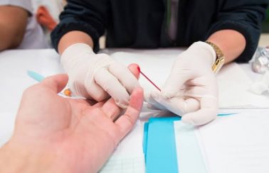 Carnaval de Salvador: testes rápidos têm 10 diagnósticos positivos para HIV