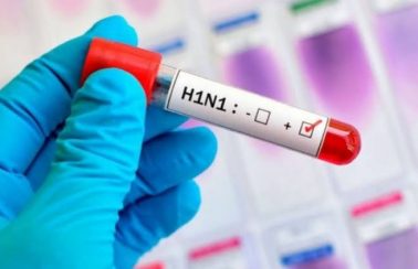 Alerta: sobe para 15 o número de casos confirmados de H1N1 no Maranhão