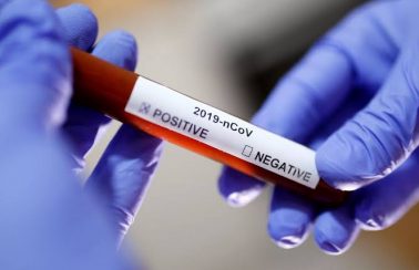 Atualização: 63 casos de coronavírus confirmados na Bahia