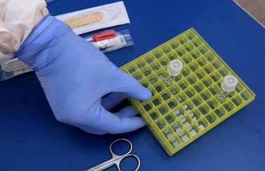 Atualização: Pernambuco registra 1.484 casos e 143 mortes de Covid-19