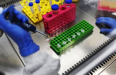Coronavírus: Ceará registra mais 5 novos óbitos e número de mortes chega a 298