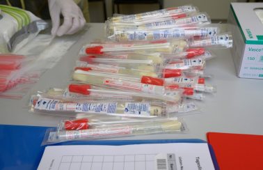 Ceará vai triplicar número de testes da Covid-19 por dia em fase de testagem massiva
