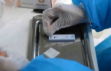Prefeitura de Fortaleza e Governo do Ceará farão mais de 9 mil testes rápidos em domicílios