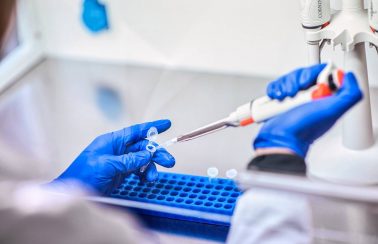 Vacina brasileira contra a Covid-19 entra em fase de testes em animais