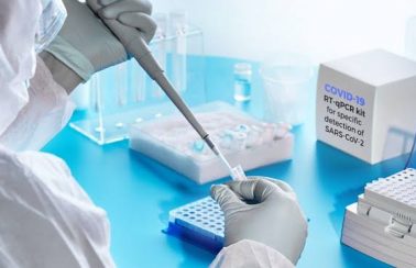 Pernambuco pretende quadruplicar testagens da covid-19