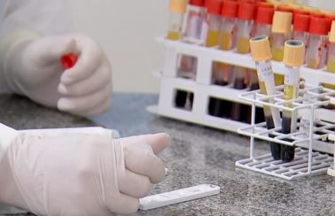 Piauí tem recorde de mortes em 24h e passa dos 10 mil casos confirmados