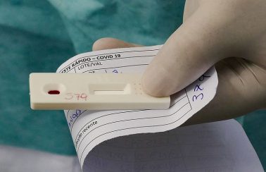 Maceió inicia nova etapa de pesquisa de testes rápidos neste domingo