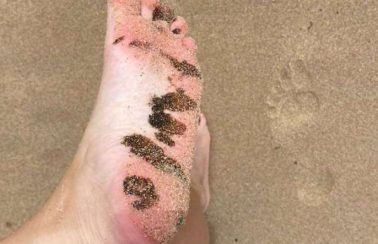 Fragmentos de óleo voltam a aparecer em praias do Nordeste