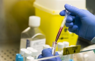 Mais de 90% dos municípios cearenses tiveram óbitos pela Covid-19