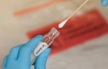 Justiça derruba liminar que obrigava plano a cobrir teste sorológico da Covid-19