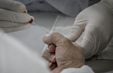 7,7% da população de Alagoas fez ao menos um teste para Covid-19 até julho, diz IBGE