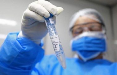 Piauí notifica dez casos de síndrome relacionada ao coronavírus