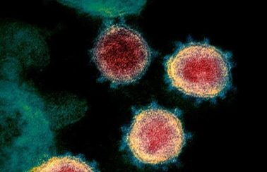 Pesquisadores da UFPE detectam perfis imunológicos brasileiros capazes de dar melhor resposta à infecção por Covid-19