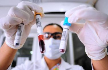 Nível de anticorpos cai rapidamente após a infecção por Covid-19, apontam estudos