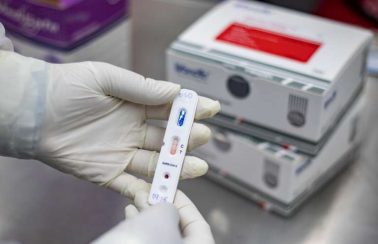 Ceará atinge marca de um milhão de testes para Covid-19 em oito meses de pandemia