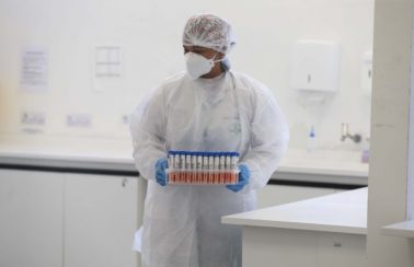 Mais de 70 casos suspeitos de reinfecção pelo novo coronavírus são investigados na BA, diz infectologista