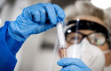 Detectado na Bahia 1º caso de reinfecção com mesma mutação do coronavírus achada na África do Sul