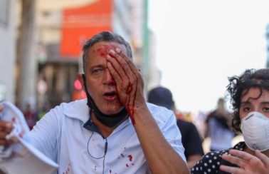 Pernambuco vai indenizar pessoas feridas durante protesto contra Bolsonaro no último sábado