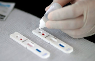 OMS fecha acordo com empresa brasileira para produzir 4 milhões de testes Covid