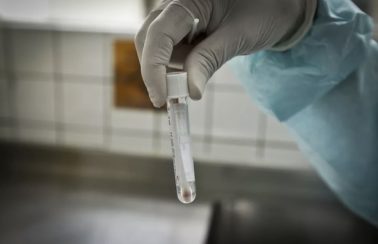 Inquérito epidemiológico em escolas da Paraíba começa nesta segunda (25)
