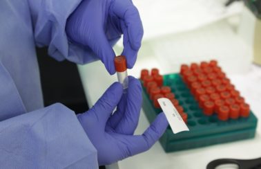 Ceará tem estabilidade de casos de Covid-19 com tendência de queda, diz governo