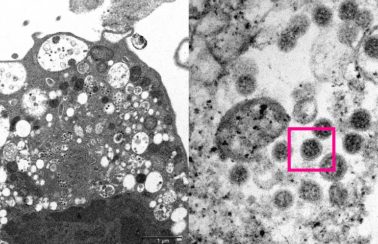 Subvariante da ômicron BA.2 é mais infecciosa do que ‘original’, diz estudo dinamarquês