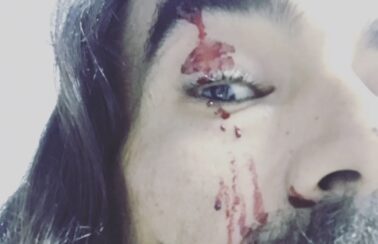 DJ denuncia espancamento em destino turístico no baixo sul da Bahia; polícia investiga homofobia