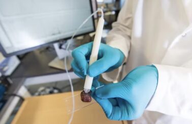 Pesquisadora brasileira cria caneta que detecta câncer em 10 segundos